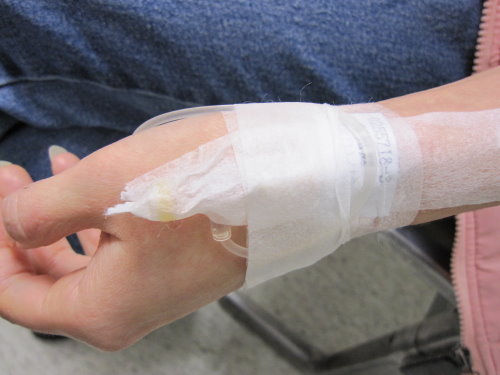 新光醫院肝膽腸胃科"無痛胃鏡"/胃痛/照胃鏡 2 新光醫院肝膽腸胃科"無痛胃鏡"/胃痛/照胃鏡